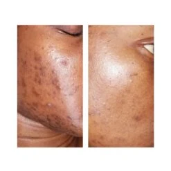 Sérum Anti-tâches MEL’OYA 30ml 5 Sérum Anti-tâches MEL’OYA 30ml -Super Beaute Boutique serum anti taches meloya 30ml 2