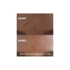 Sérum Unifiant Anti-Tache Bio VITAMINE C & BUSSEROLE 30ml 5 Sérum Unifiant Anti-Tache Bio VITAMINE C & BUSSEROLE 30ml -Super Beaute Boutique serum unifiant anti tache bio vitamine c busserole 30ml 1