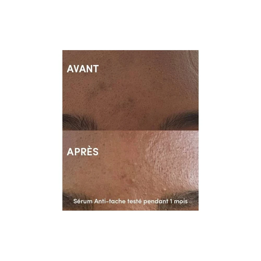 Sérum Unifiant Anti-Tache Bio VITAMINE C & BUSSEROLE 30ml 3 Sérum Unifiant Anti-Tache Bio VITAMINE C & BUSSEROLE 30ml – Image 3