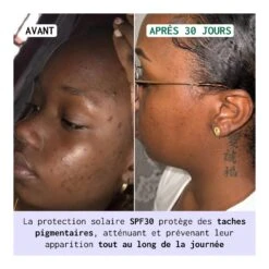 Soin Correcteur D'Hyperpigmentation FORMULE JOUR 50ml 7 Soin Correcteur D'Hyperpigmentation FORMULE JOUR 50ml -Super Beaute Boutique soin correcteur d hyperpigmentation formule jour 50ml 3